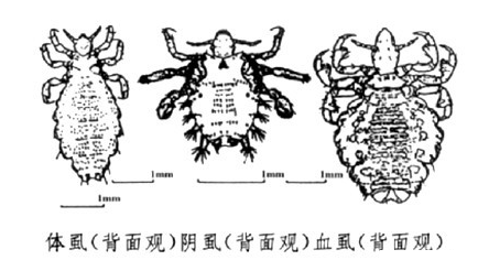 治阴虱多少钱？
